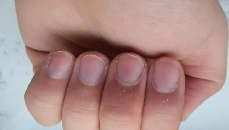 指甲上的月牙小是不是身体不健康（指甲上的月牙小表示身体不健康吗）